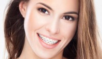 Ortodontik Tedavi Her Yaşta Mümkün Olur Mu?
