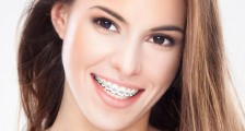 Ortodontik Tedavi Her Yaşta Mümkün Olur Mu?